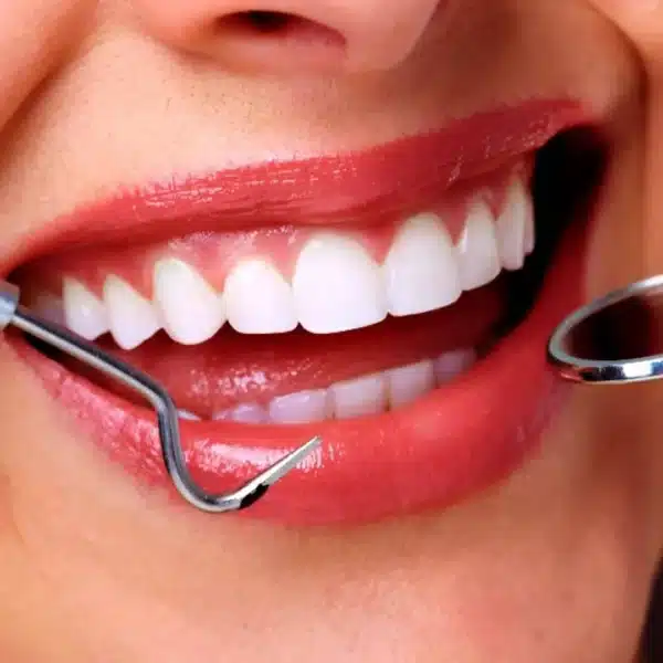 Update on Retiree Dental Plan